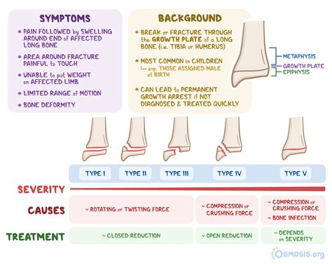 Salter-Harris Fracture: What Is It, Types, Treatment, and More