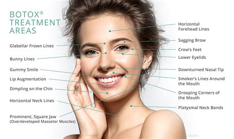 Everything you need to know about Botox - Bella Donna Med Spa