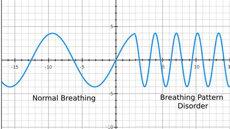 Dysfunctional breathing - What is it and How can I manage it?