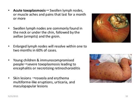 Zoonotic disease