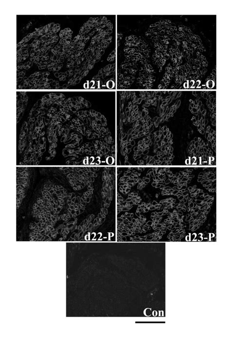 Immunofluorescence analysis of Hic-5 protein expression in the ...