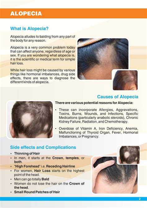 What is Alopecia Hair Loss - Types/Causes/Diagnosis and Treatment - By Looks Forever Hair And ...