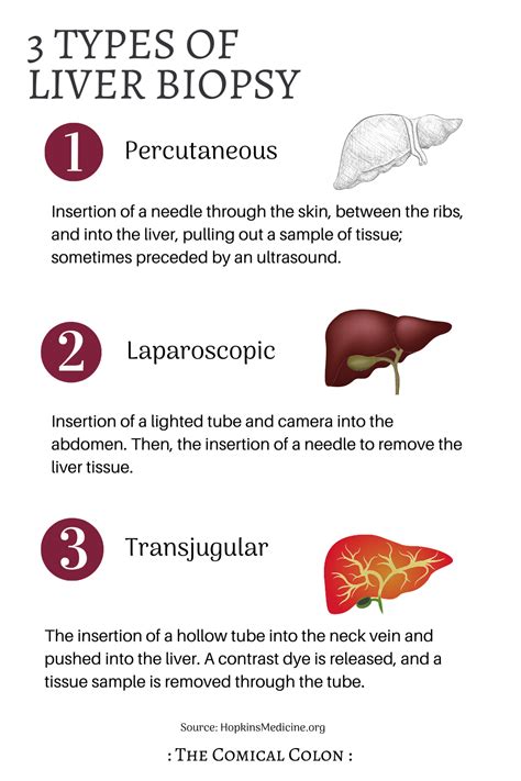 What to Expect at your Ultrasound-Guided Liver Biopsy Procedure