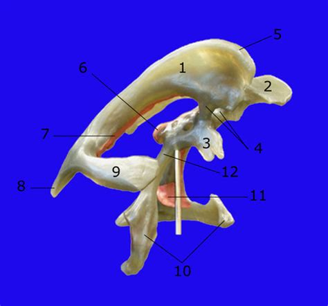 BIO67A (lab) - BRAIN VENTRICLES: ANTEROLATERAL Flashcards | Quizlet