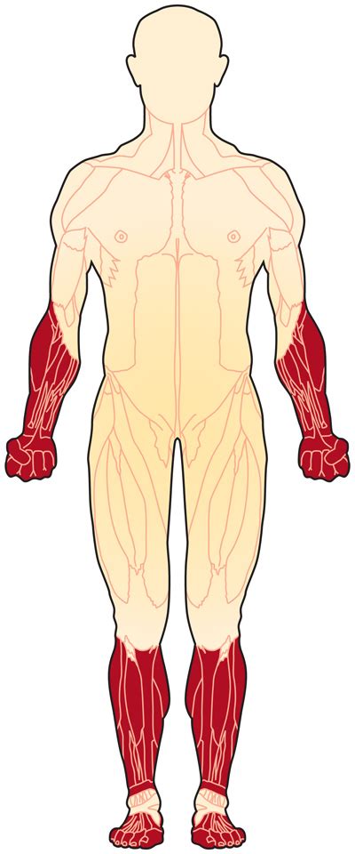 Overview | Distal Muscular Dystrophy | MDA