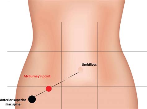 Your Appendix – A built in probiotic – Nutriplexity