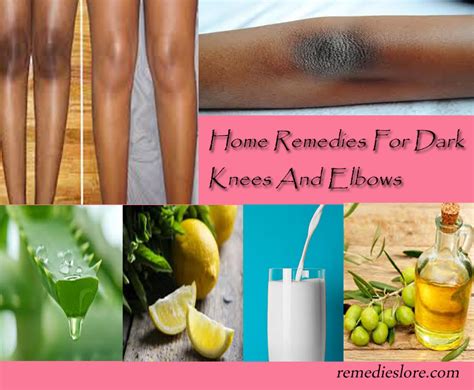 How to Get Rid of Dark Knees and Elbows - Remedies Lore