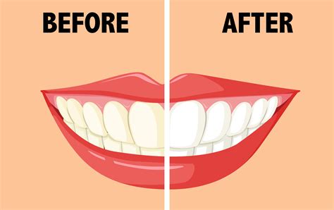 Before and after brushing teeth 293918 Vector Art at Vecteezy