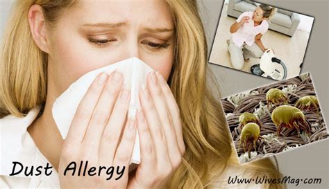 Dust allergy, causes, symptoms & treatment