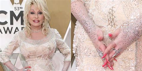 Why Does Dolly Parton Wear Fingerless Gloves and Cover Her Hands?