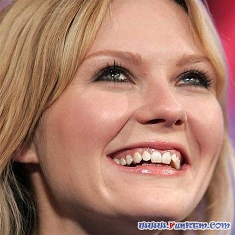 Celebrities With Ugly Teeth (13 Pics)