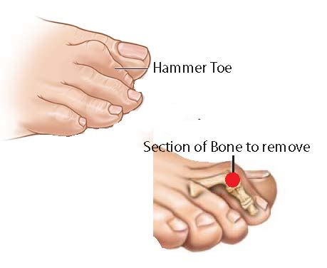 Bone and Joint Specialists Patient Education