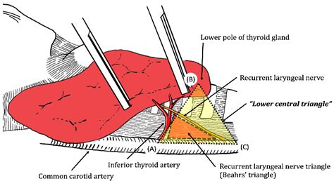 Recurrent Laryngeal Nerve In Thyroidectomy