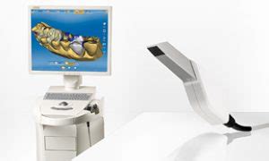 Sirona Cerec Digital Impressions | Thompson Suburban Dental Laboratory