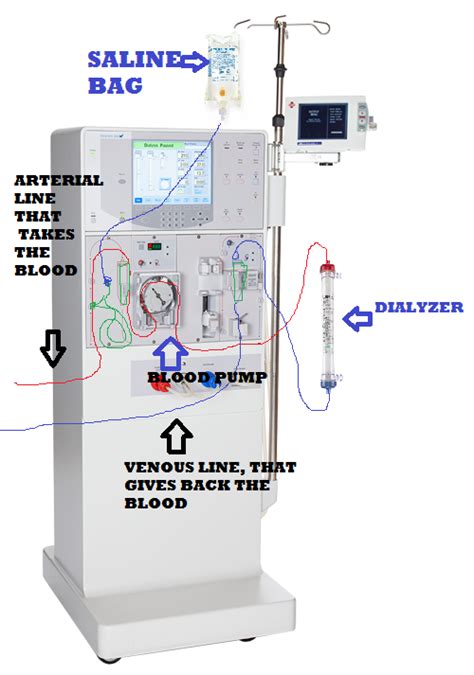 *Dialysis Technicians WorldWide*: Setting up K/T 2008 dialysis machines