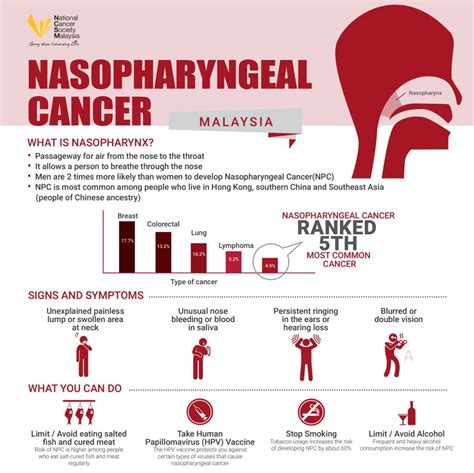 Nasopharyngeal Cancer – National Cancer Society of Malaysia