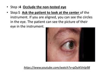 Keratometer | PPT