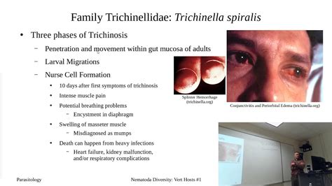 Trichinella spiralis - YouTube