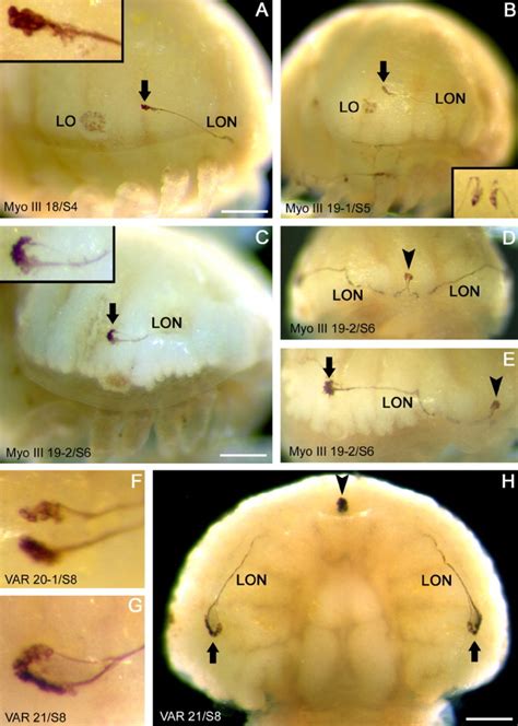 Evolution of arthropod visual systems: Development of the eyes and central visual pathways in ...