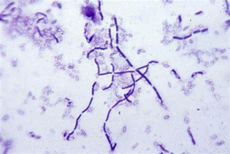 Bacillus Subtilis Spore Stain