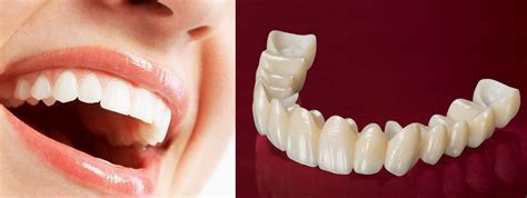 Zirconia Crown | Cost of Zirconia Treatment | Jussmile.com