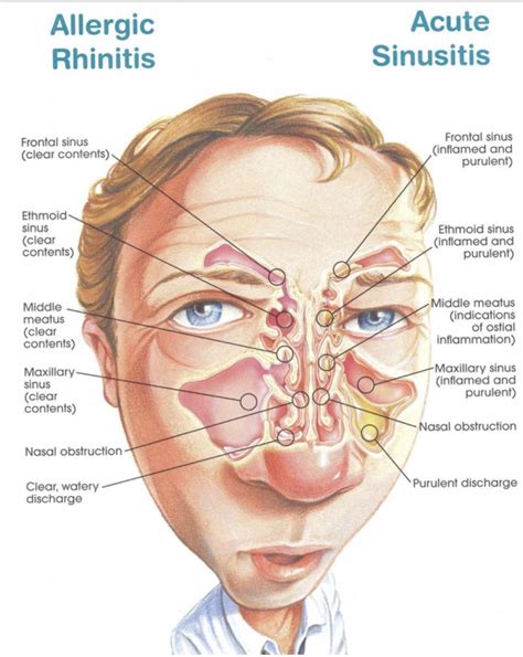 Ear And Sinus Diagram