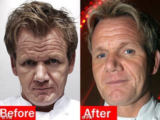 Gordon Ramsay Plastic Surgery Before and After Botox and Facelift ...