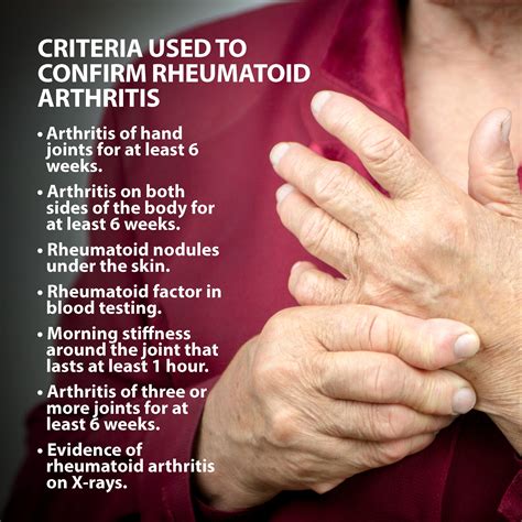 Rheumatoid Arthritis Of The Hand | Florida Orthopaedic Institute