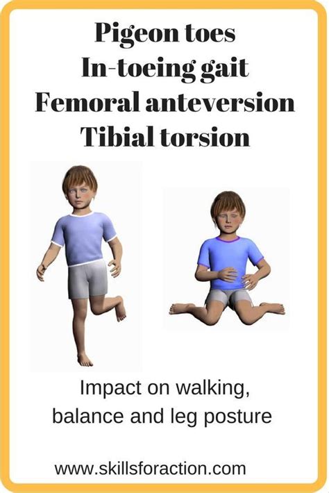 How femoral anteversion affects leg posture, walking and balance in children. Pediatric Physical ...