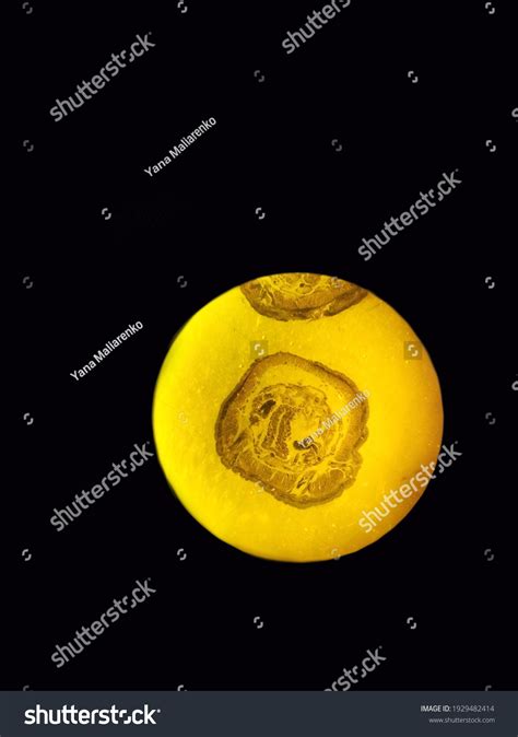 Cross Section Earthworm Internal Structure Earthworm Stock Photo (Edit Now) 1929482414