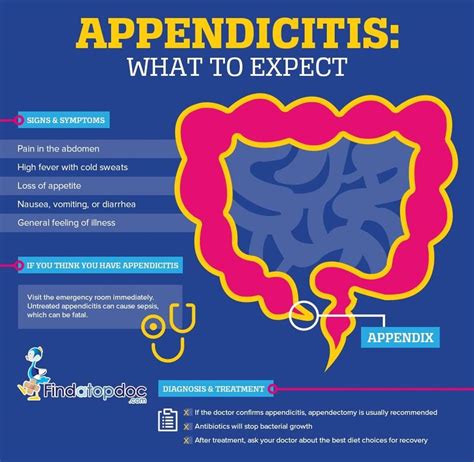 Abdominal Pain: Is It Appendicitis?