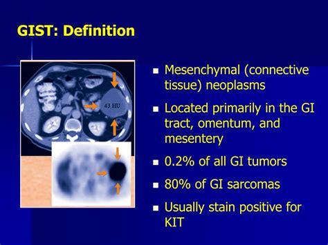 PPT - Gastrointestinal Stromal Tumor GIST New Therapeutic Approaches PowerPoint Presentation ...