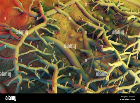 Close up view of athlete's foot fungus Stock Photo - Alamy