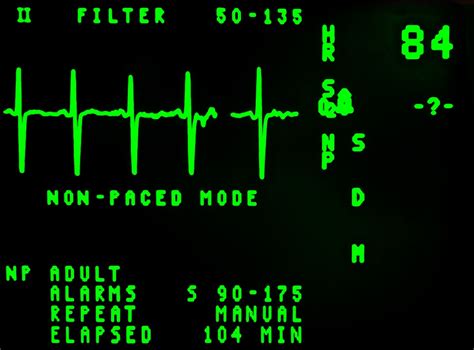 Transcutaneous Pacing — Downeast Emergency Medicine