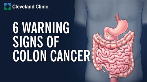 Types Of Rectal Tumors