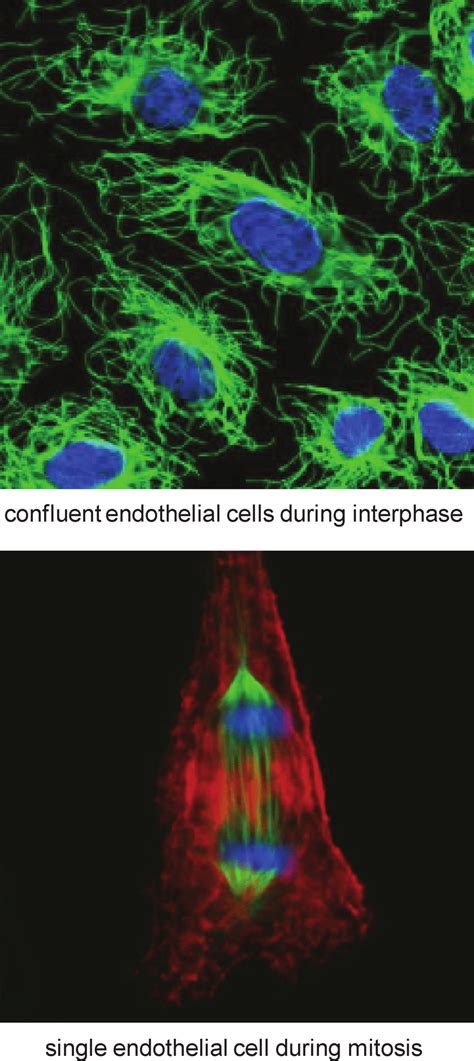 Tubulin in human endothelial cells-distribution of tubulin in the ...