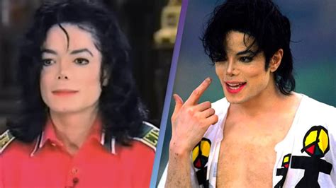 Michael Jackson explained his skin disorder after claims he was bleaching it to become white