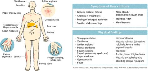 Sports Illustrated: How To Tell If You Have Liver Problems