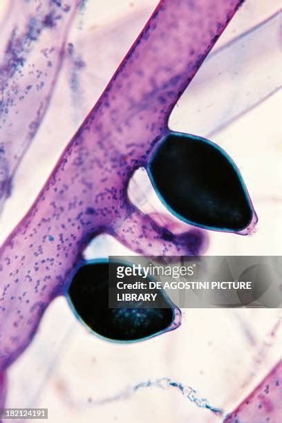 Algae Under Microscope Photos and Premium High Res Pictures - Getty Images