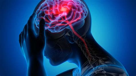 Increased Intracranial Pressure: A Guide For Nurses | Ausmed