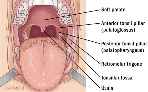 Tonsillectomy Anatomy