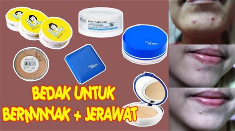 Bedak Yang Cocok Untuk Muka Berjerawat - Homecare24