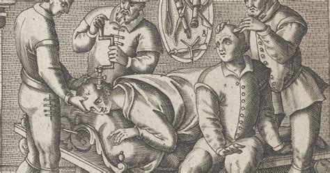 Trepanation: Our ancestors' idea of neurosurgery