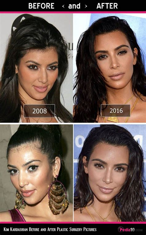 Kim Kardashian Face Pics - (Plastic Surgery Before and After) - Photo 5 | Plastic surgery ...