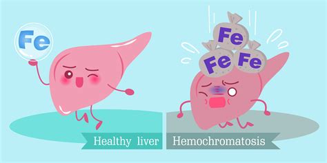 Haemochromatosis - When You Have Too Much Iron In Your Body | MyHealth1st