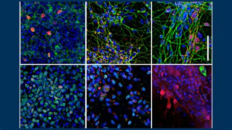 Recipe for human neuron development - Allen Institute