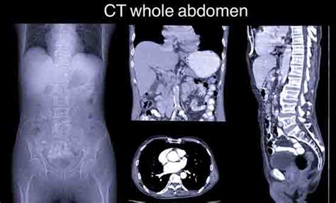 Full Body CT Scan In Panvel | Computed Tomography Scan | Whole-body Multislice Computed ...