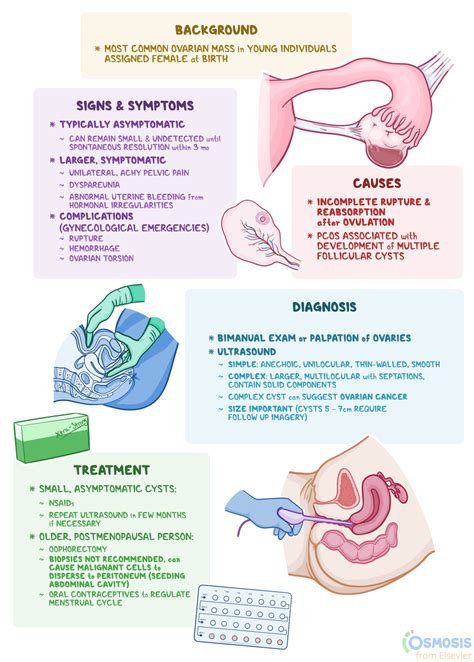 Follicular Cyst: What It Is, Causes, Signs, Symptoms, and More | Osmosis