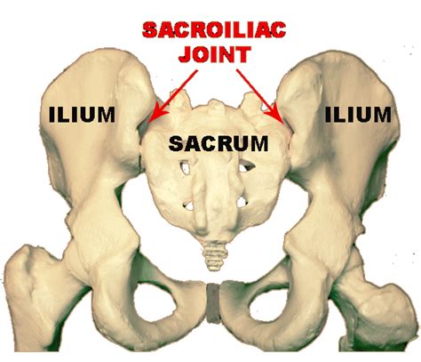 Sacroliliac Joint Dysfunction Diagnosis and Treatment