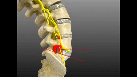 38 spine l5 s1 diagram - Diagram Online Source - DaftSex HD